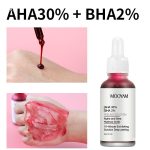 AHA + BHA peel